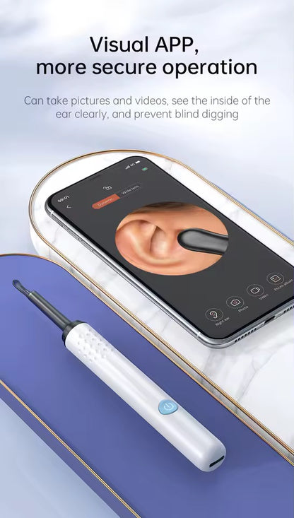 Earwax Remover Tool with Camera