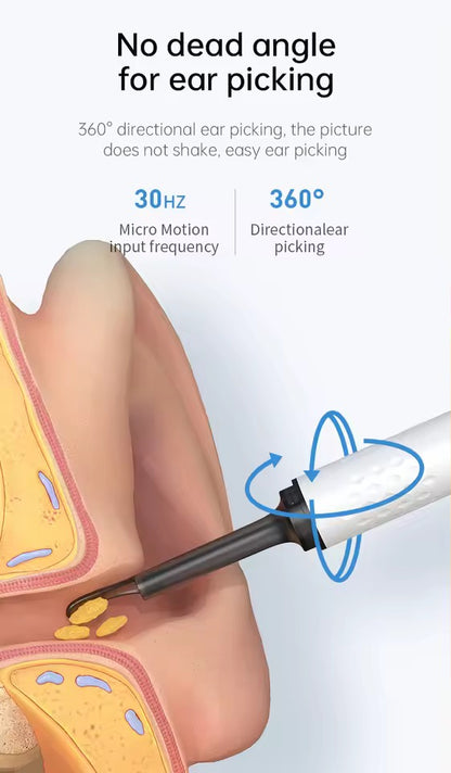 Earwax Remover Tool with Camera